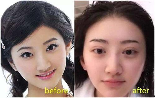 外双眼皮明星,揭秘外双眼皮的魅力与秘密